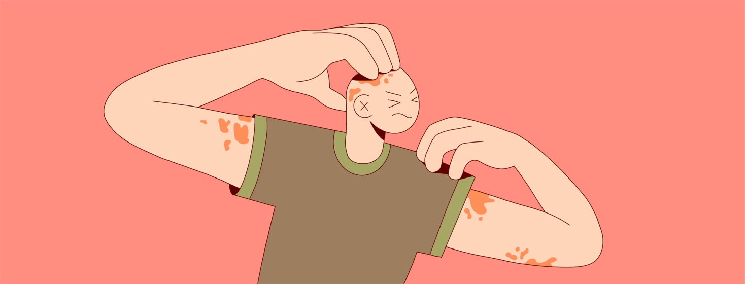 A man scratches at itchy patches on his skin