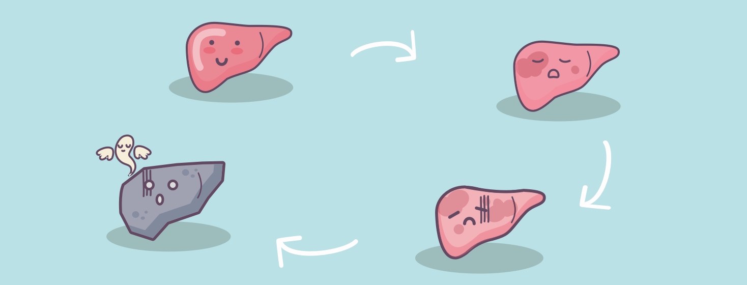The Four Stages of Liver Disease Caused by Hepatitis C