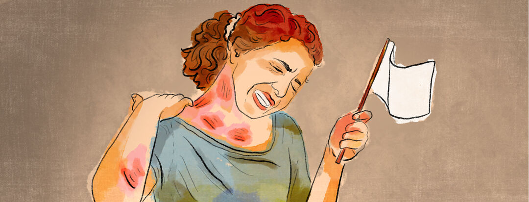 Fatigue and Apathy with Hep C image