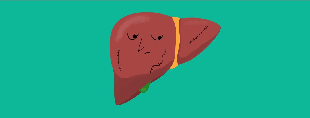 A liver with a sad face