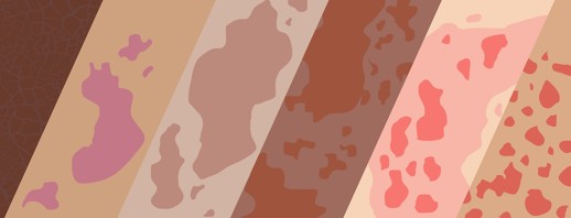How Hepatitis C Affects Skin: Common Skin Conditions image