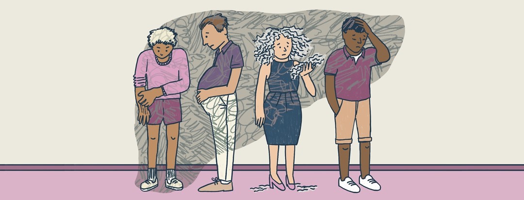 Four people stand together, experiencing different symptoms of Hepatitis C including dry, itchy skin, swollen belly, crazy hair, and depression.