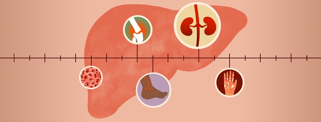 A liver sits behind a timeline of medical events.