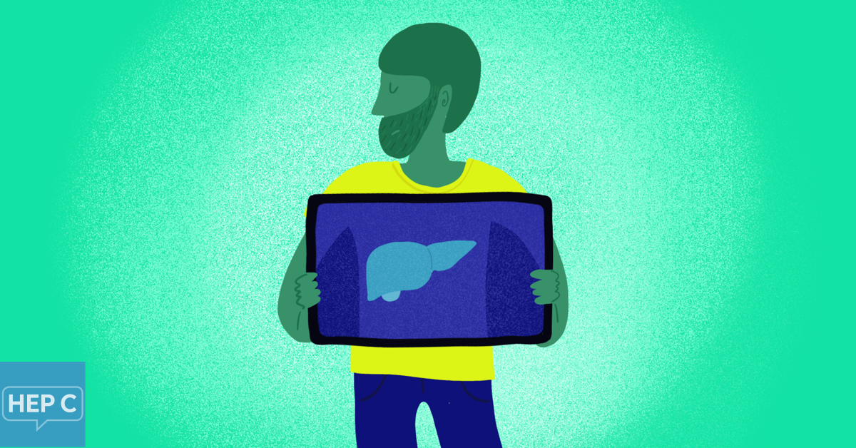 Liver Transplant for Hepatitis C