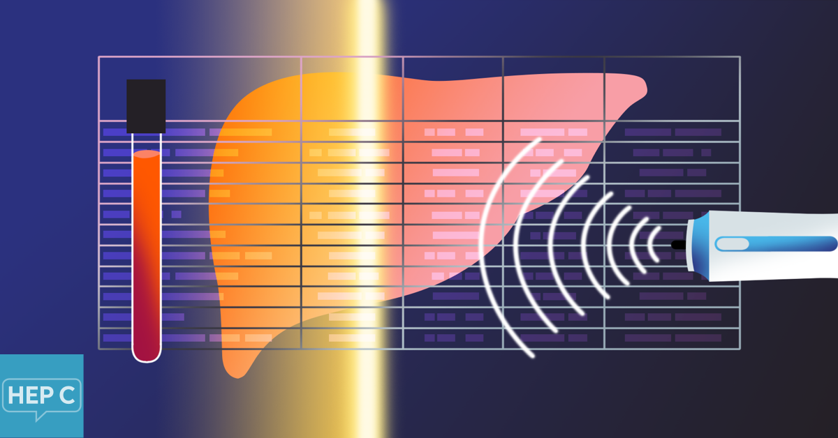 Lab Tests to Diagnose and Monitor Hepatitis C and Liver Disease