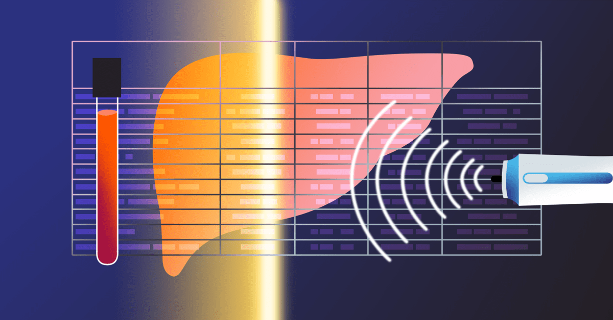 Why Followup Tests Are Important after Hepatitis C Treatment