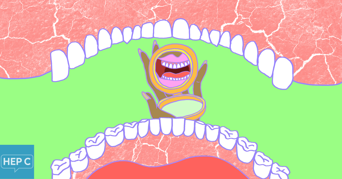 Dental Problems Caused By Hepatitis C and Hep C Treatment