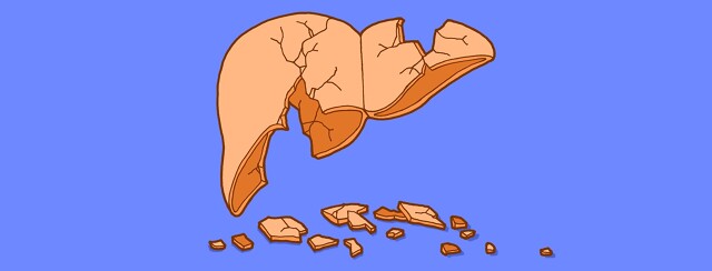 Common Causes of Liver Damage image