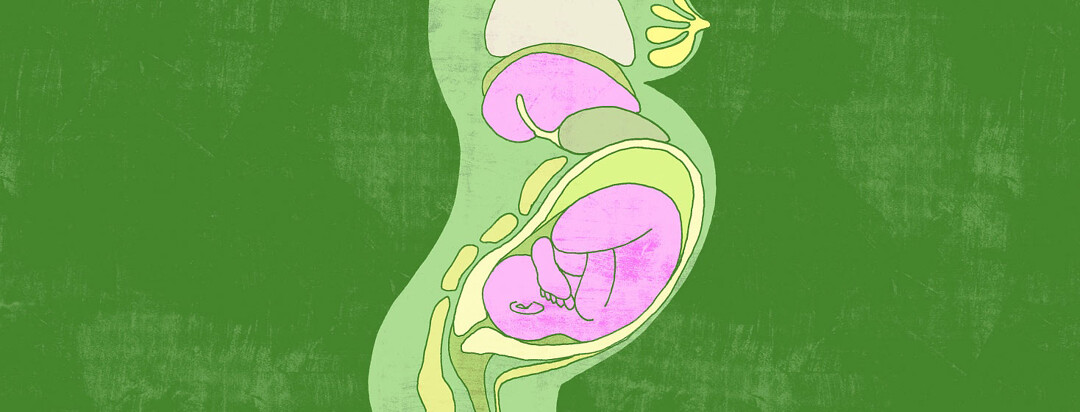 a scientific illustration of inside the human body of a woman with hep C while pregnant, highlighting both the baby and the liver