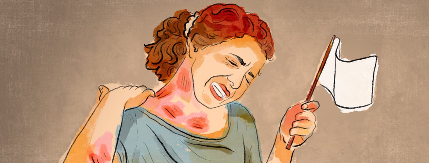 a woman scratching her skin and leaving red welts and scabs